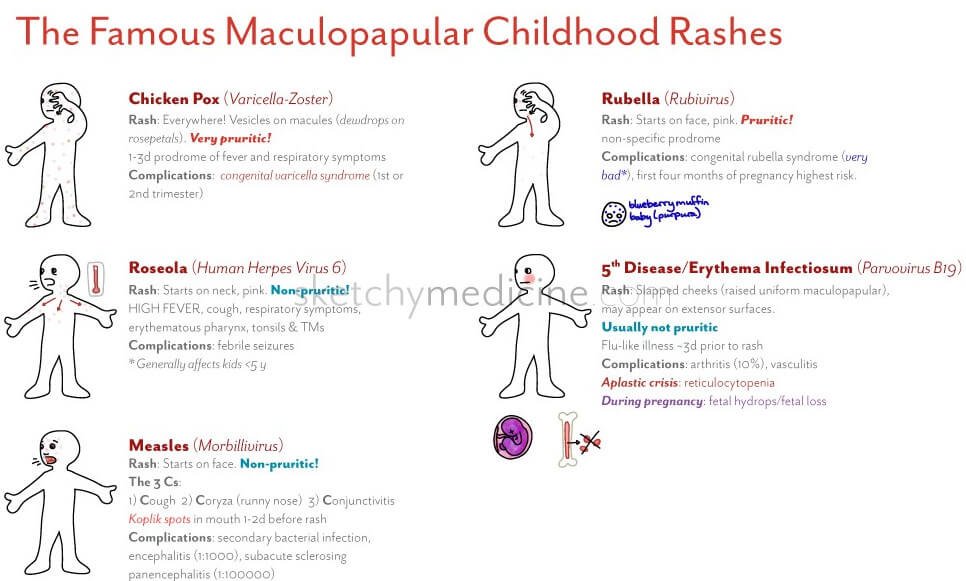 Maculopapular Drug Eruptions - smstaging.stanford.edu