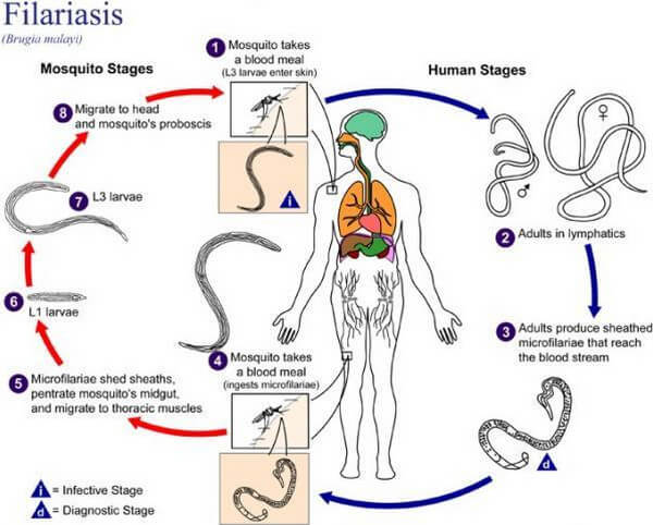 filariasis picture cycle