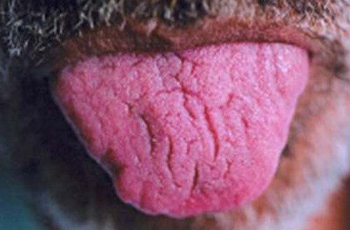 Fissured Tongue image