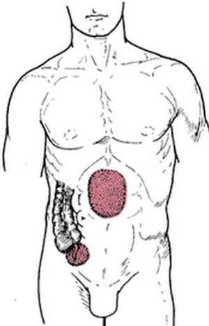 Areas affected by appendicitis