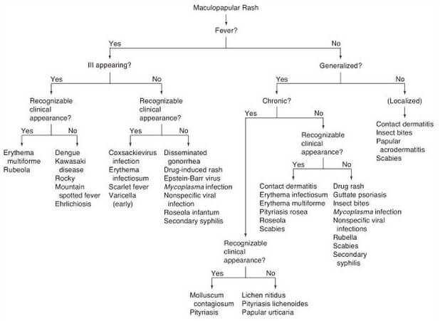 Maculopapular Rash flow chart diagnosis