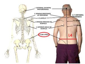 Surface Anatomy of the Iliac Crest picture