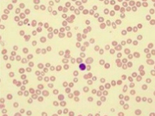 Leukopenia smear