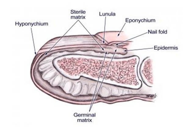 subungual hematomas subungual melanoma germinal matrix