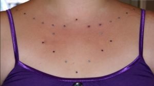 Chest-dermal-piercings