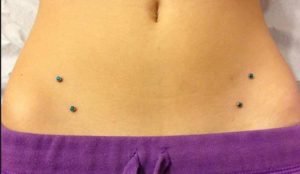 Hip-dermal-piercing