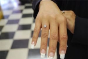 dermal-piercing-finger-ring