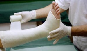 Greenstick Fracture - Definition, Causes and Treatment