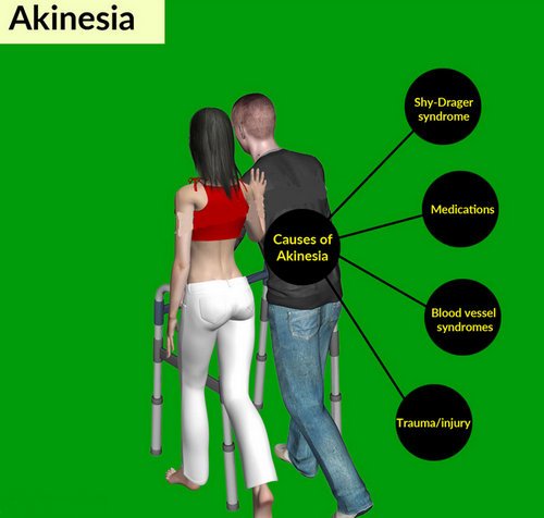 A patient with akinesia being taken care of by a significant other. It also outlines the possible causes of akinesia.photo