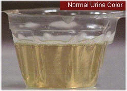 A normal colored urine.photo