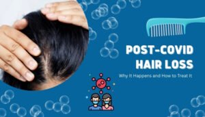 Post-COVID Hair Loss: Why It Happens and How to Treat It