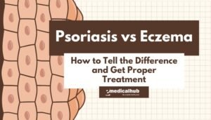 Psoriasis vs Eczema: How to Tell the Difference and Get Proper Treatment