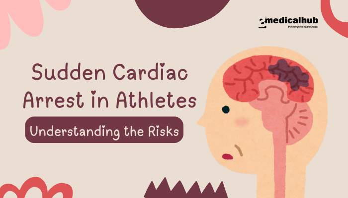 Sudden Cardiac Arrest in Athletes: Understanding the Risks