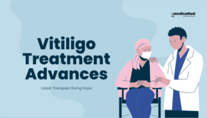 Vitiligo Treatment Advances: Latest Therapies Giving Hope