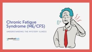 Chronic Fatigue Syndrome (ME/CFS): Understanding the Mystery Illness