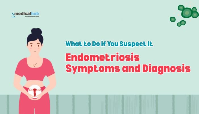 Endometriosis Symptoms and Diagnosis: What to Do if You Suspect It